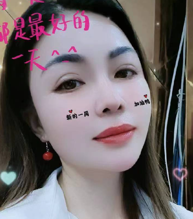 钟晓芳